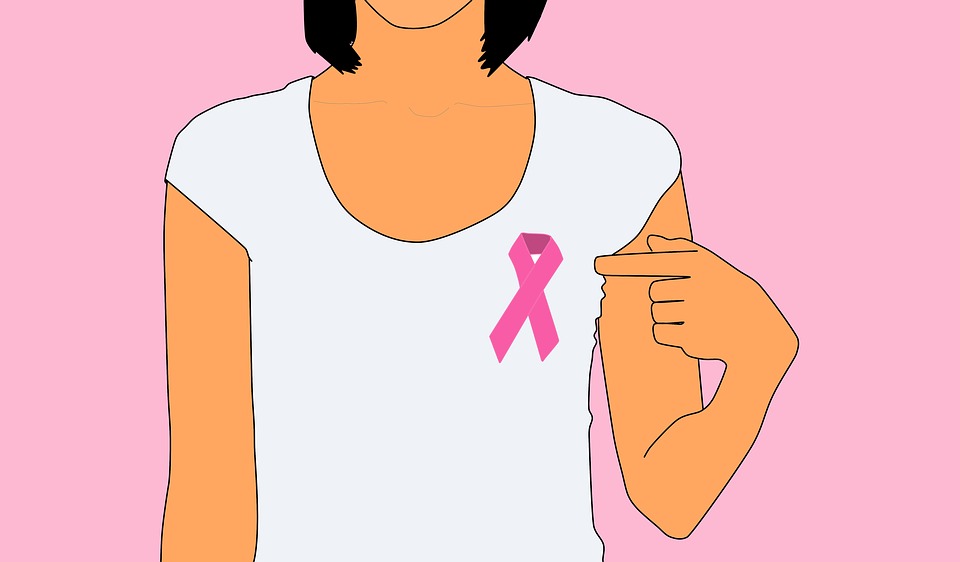 Read more about the article Breast Cancer, The Most Frequently Diagnosed Cancer In Women